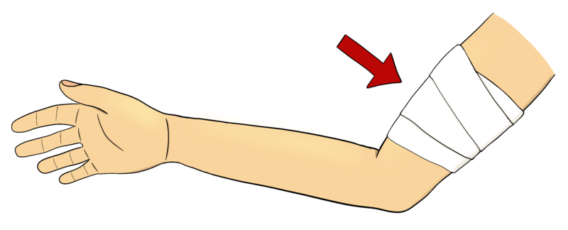 Datei:CA Verband.png